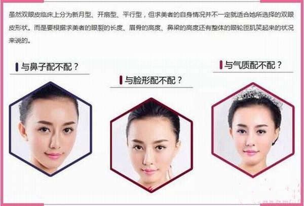 如何更根据脸型选择适合自己的<a href='/tag_shuangyan108.html'>双眼</a>皮术？
