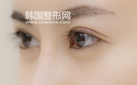为什么要做<a href='/tag_shuangyanpishoushu6.html'>双眼皮手术</a>？