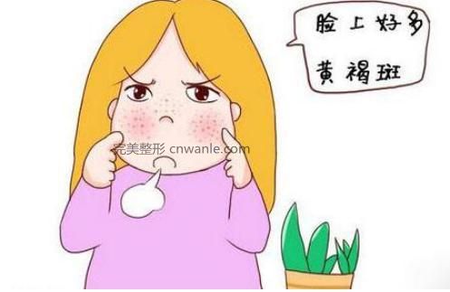 激光去黄褐斑时间长吗?需要多久恢复