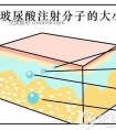 玻尿酸丰面颊2个月效果不明显能溶掉再填充脂肪吗