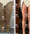 大腿吸吸脂后还会不会反弹