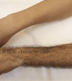 手臂做冰点激光脱毛的优势