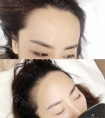 杭州半永久纹发际线好不好