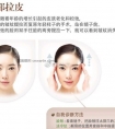 电波拉皮手术第二次做还会有效果吗?