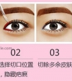 开眼角真的能让眼睛变大吗?