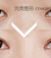 怎么让眼睛看起来更大更好看呢
