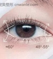 开眼角几天恢复自然