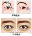 开眼角真的能放大双眼么 以及注意事项
