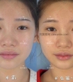 不打唇珠,你永远不知道自己有多美!为什么有的小仙女