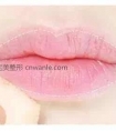 湖南韩美唇珠成型术效果怎么样