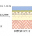 激光除皱能维持多久
