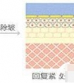 做激光除皱多少钱?一般效果好不好,具体可以维持多久
