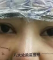 热玛吉要每年做一次吗?看完这些再去做热玛吉!