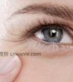 激光去鱼尾纹效果好吗?激光去鱼尾纹优点有哪些?