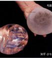 有没有人做过假体隆胸,想问一下用了什么材料?效果如何?