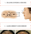 害怕假体隆鼻有风险,只需做项鼻尖整形也能改变效果哦