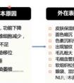 那些打了玻尿酸和肉毒素的人现在怎么样了呢?