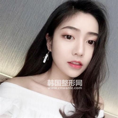 电波<a href='/tag_lapi2.html'>拉皮</a>的作用是什么?