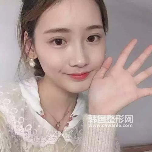 <a href='/tag_mianbutisheng17.html'>面部提升</a><a href='/tag_quzhou26.html'>祛皱</a>有什么好方法？