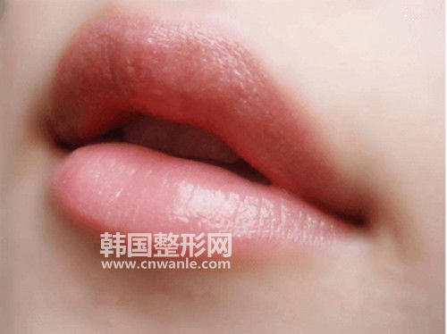 口角成型<a href='/tag_zhengxingshoushu5.html'>整形手术</a>前和术后需要注意的事项有哪些?