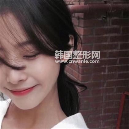 口角成型的手术的原理和过程是怎样的?