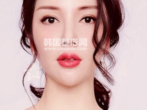 飞顿2号<a href='/tag_fuhecaiguang2.html'>复合彩光</a>的优势有哪些？