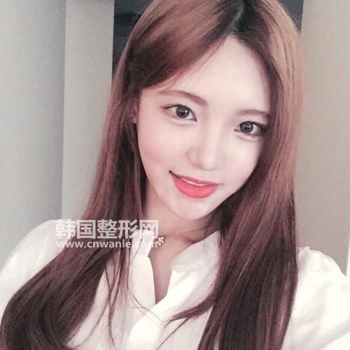 <a href='/tag_maofayizhi6.html'>毛发移植</a>术后注意事项?