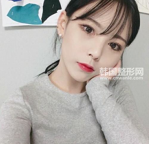 3D生态纳米隆鼻与传统隆鼻比较的优势有哪些?