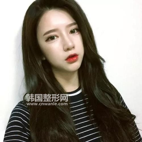 激光<a href='/tag_quzhi12.html'>祛痣</a>有何风险与副作用？应该如何预防和避免？