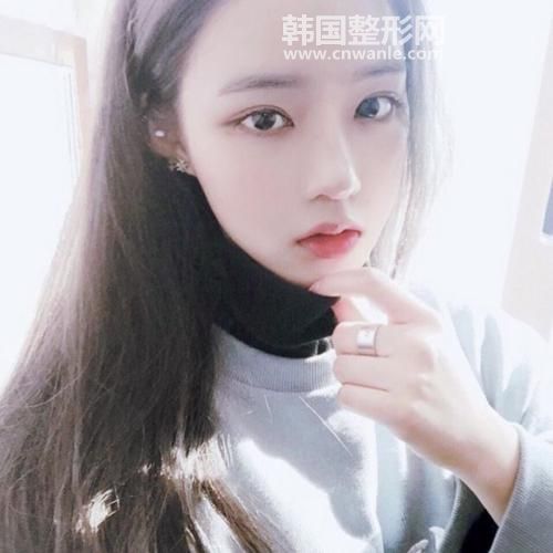 激光<a href='/tag_quzhi12.html'>祛痣</a>的效果好吗?容易反弹吗?
