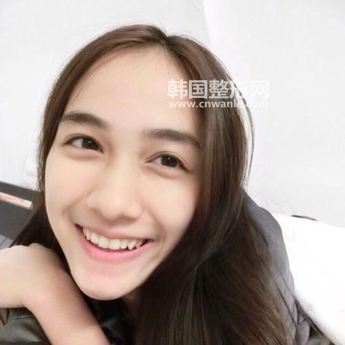 现在割<a href='/tag_shuangyanpidejia.html'>双眼皮的价格</a>是多少钱?