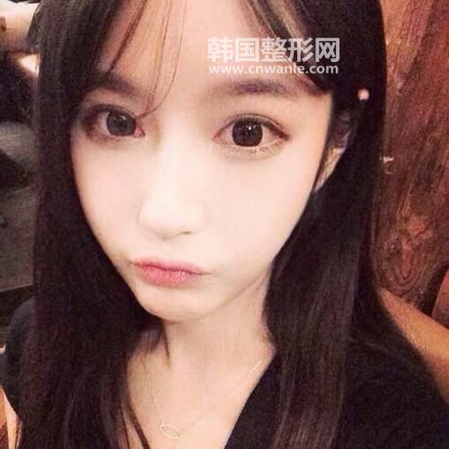 <a href='/tag_maixian35.html'>埋线</a><a href='/tag_shuangyan108.html'>双眼</a>皮断了怎么办?如何修复?