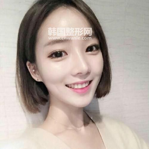       很多人理解<a href='/tag_wocan4.html'>卧蚕</a>和<a href='/tag_yandai21.html'>眼袋</a>容易混淆。卧蚕是我们中国人用来形容的名称，相当贴切生动，卧蚕是紧邻<a href='/tag_jiemao3.html'>睫毛</a>下缘一条约四到七毫米带状隆起物，看来好像一条蚕宝宝横卧在下睫毛的边缘，笑起来才明显，让眼神变得可爱。眼袋虽然也是一团凸出物，但距离下睫毛较远，是大量脂肪堆积在人的下眼睑皮下组织中久而久之形成的一半圆形的袋状物，主要是脂肪凸出所致。分辨的方法是眼袋是三角型，但卧蚕是椭圆型；眼袋不论脸部表情为何都会出现，卧蚕笑起来才会特别明显。基本上有卧蚕的人看起来好象眼睛会笑，是十分有魅力的眼睛，与眼袋肌肤问题截 然不同。有卧蚕表示异性缘很好！