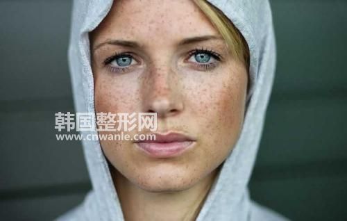 <a href='/tag_huangheban58.html'>黄褐斑</a>是什么 它是怎么产生的 如何<a href='/tag_quchuhuangheban6.html'>去除黄褐斑</a>?