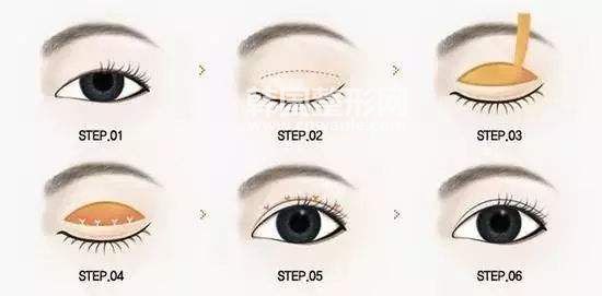 埋线双眼皮和<a href='/tag_quanqieshuangyanpi4.html'>全切双眼皮</a>的区别