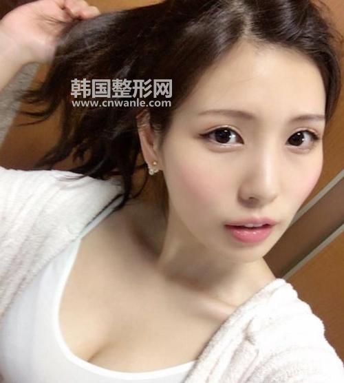 去眼袋大概需要多少钱?