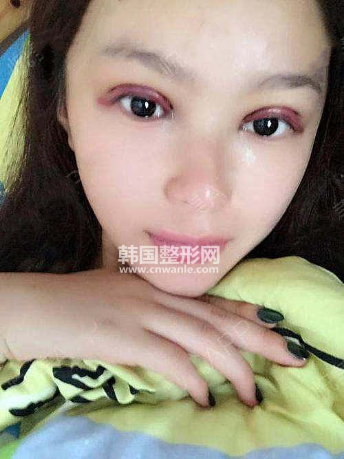 /uploads/files_user1/article/5eca70a395810691525.jpg
