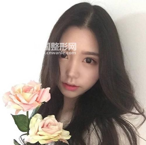 请问做埋线<a href='/tag_shuangyanpi53.html'>双眼皮</a>以后多久可以恢复自然状态出门？