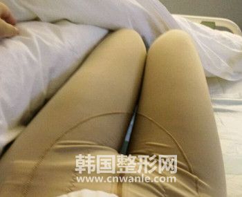 抽脂一定要穿塑身裤吗?