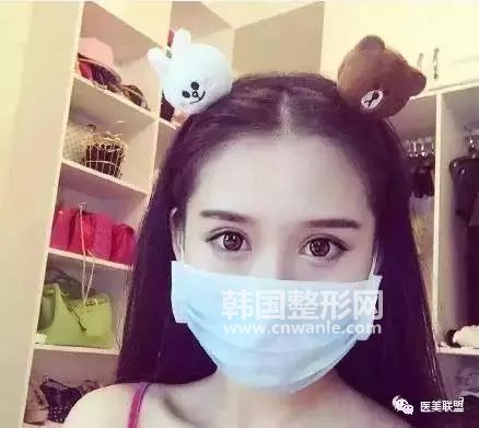 开内眦真的会使眼睛变大吗?开内眦就是<a href='/tag_kaiyanjiao68.html'>开眼角</a>吗?