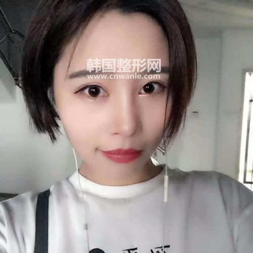 <a href='/tag_maixian35.html'>埋线</a><a href='/tag_shuangyan108.html'>双眼</a>皮效果图 埋线<a href='/tag_shuangyanpi53.html'>双眼皮</a>能保持多久