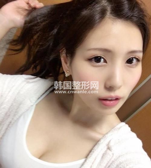 <a href='/tag_kaiwaiyanjiao4.html'>开外眼角</a>有哪些效果?