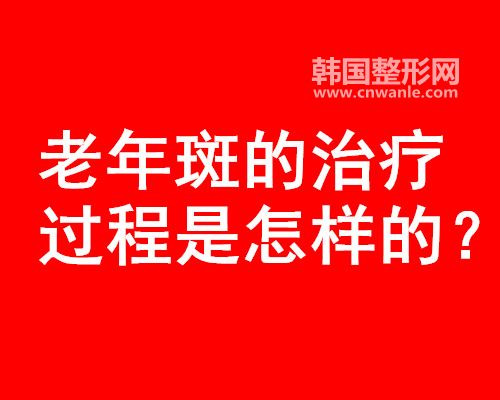 <a href='/tag_laonianbandezhi.html'>老年斑的治疗</a>过程方法是怎样的？