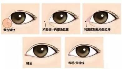 O3c完美整形-全国韩式<a href='/tag_zhengxingmeirongyi6.html'>整形美容医院</a>在线咨询平台