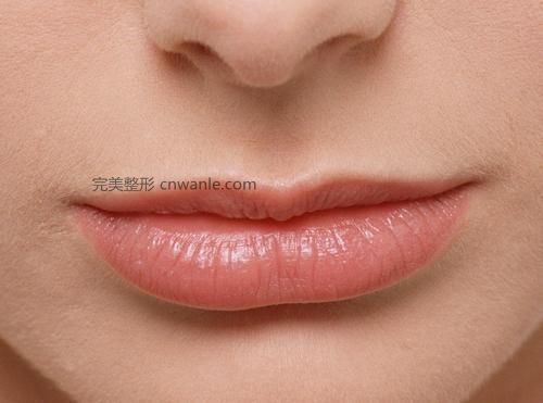 <a href='/tag_houchun2.html'>厚唇</a>变薄术后有疤吗？
