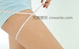 温州艺星大腿吸脂