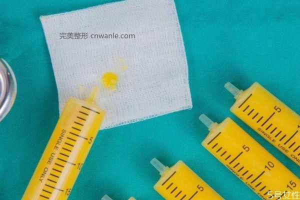 小腿<a href='/tag_xizhihuifandan.html'>吸脂会反弹吗</a> 小腿吸脂能反弹吗