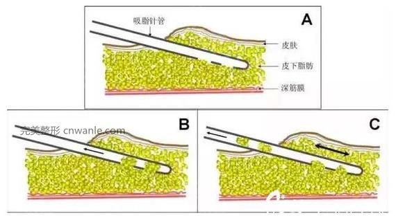 头条