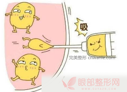 <a href='/tag_datuixizhi10.html'>大腿吸脂</a>术后暴饮暴食体重还是会反弹但只是脂肪细胞体积增大了