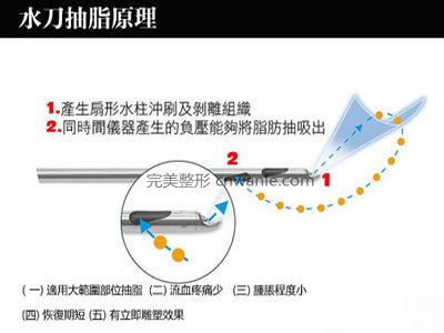 腿部吸脂会反弹吗?